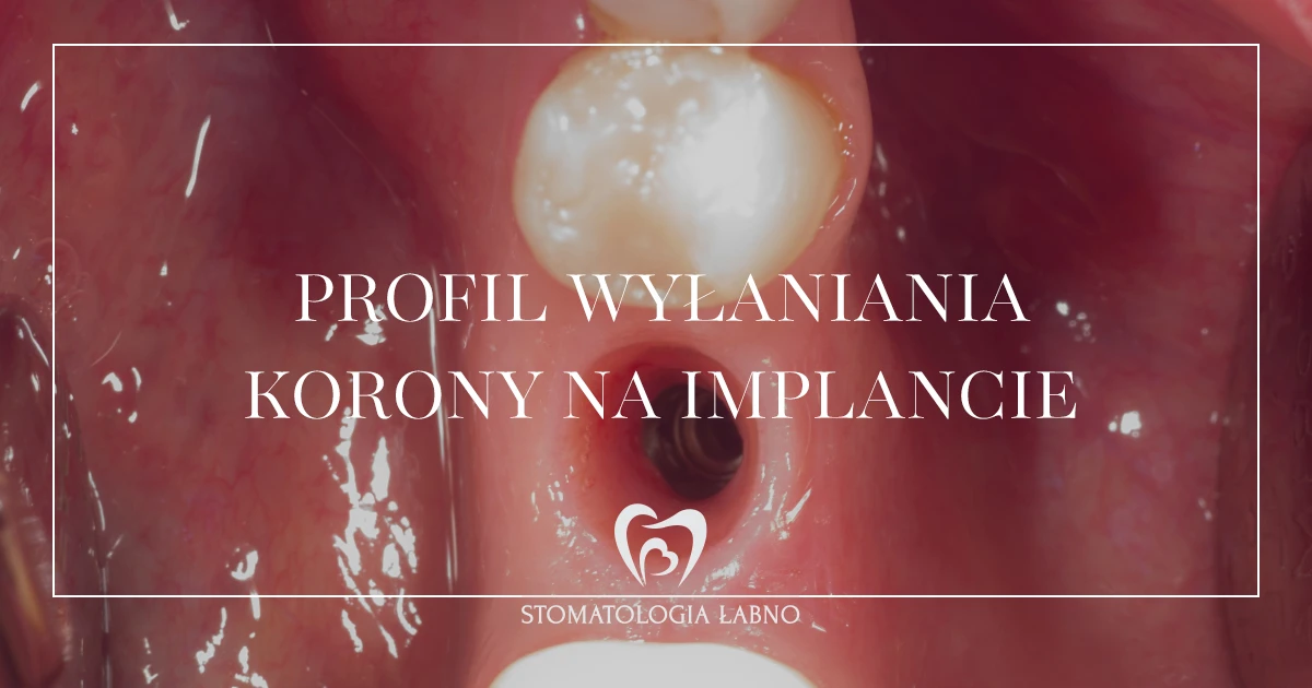 Przypadek leczenia w Stomatologii Łabno